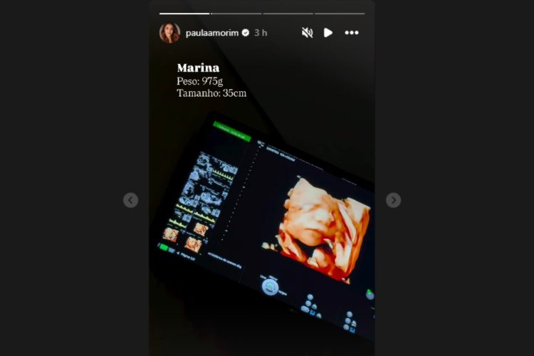 stories do ultrassom da segunda gravidez de paula amorim