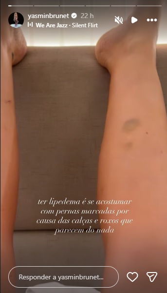 Yasmin Brunet Stories